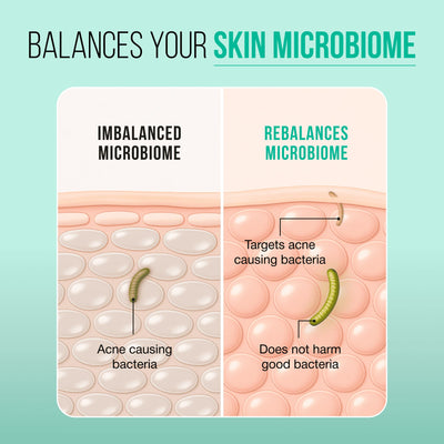 Salicylic Acid for Pores: The Expert-Approved Way to Clear, Minimize, and Refine Your Skin