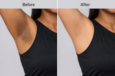 How to Brighten Dark Underarms & Even Body Tone: The Complete Guide