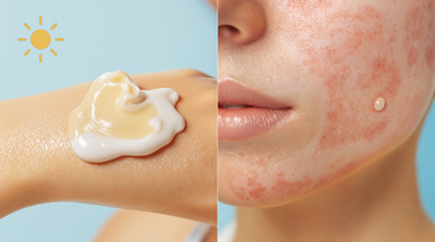 The Importance of Sunscreen for Dermatitis: A Complete Protection Guide