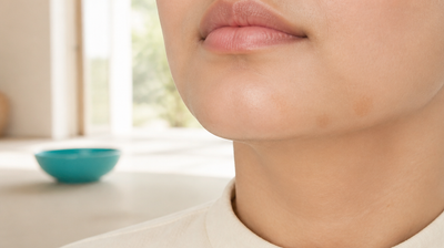 Close view of a woman's jawline and chin showing a few small flat faded healing marks, with nothing touching the skin