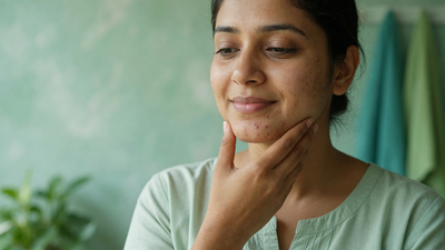 Indian woman in her late twenties touching her jawline, showing mild hormonal acne and post-acne marks along the chin and jaw
