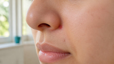 Close-up of a small red pimple in the crease beside a woman's nostril, with a smaller bump further down the fold