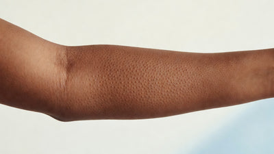 Rough keratosis pilaris bumps on an upper arm, warm brown Indian skin