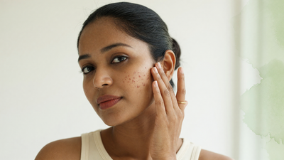 Young Indian woman with acne-prone skin and fading post-acne marks touching her cheek