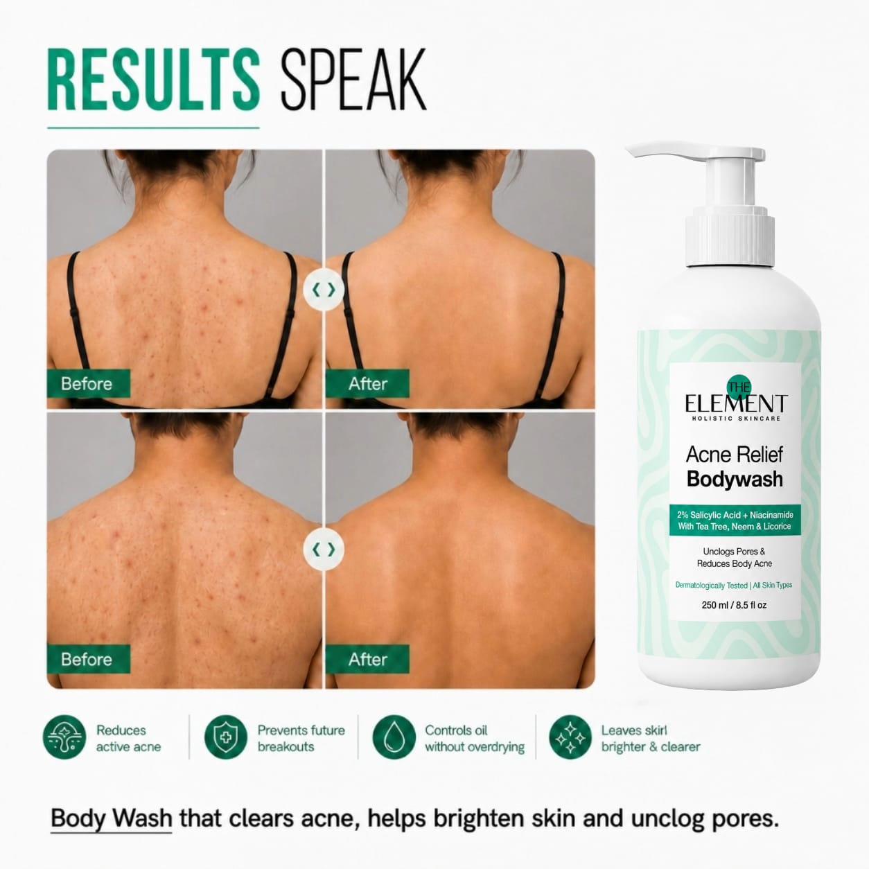 Results - reduces active body acne, prevents future breakouts, controls oil without overdrying, clearer skin on back and shoulders