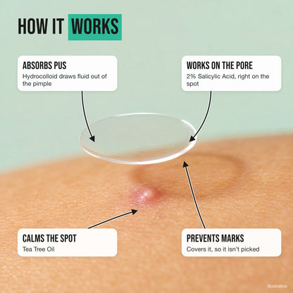 How the pimple patch works: absorbs pus, works on the pore, calms the spot and prevents marks