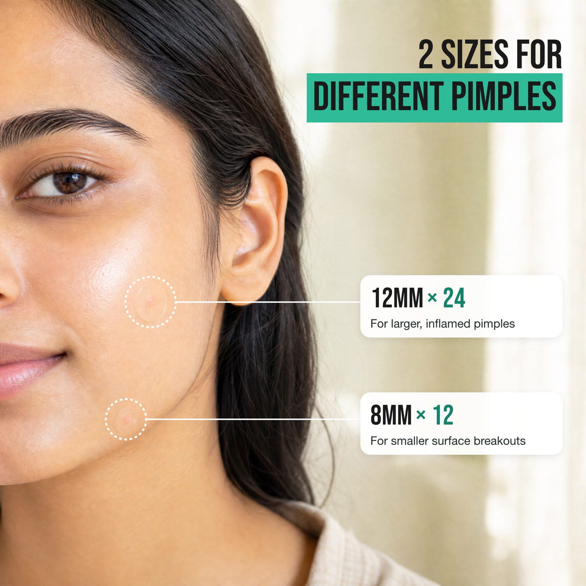 2 sizes: 12mm × 24 for larger, inflamed pimples and 8mm × 12 for smaller surface breakouts