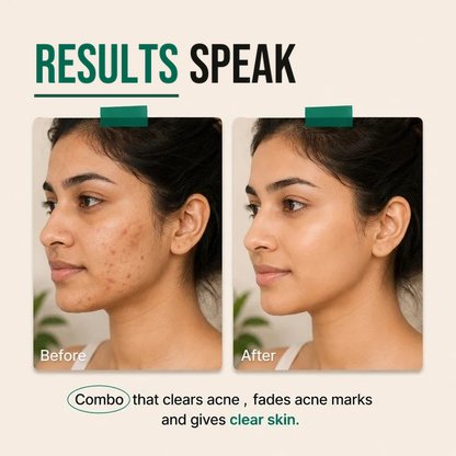 Holistic Acne-Clear Kit - Inside–Out Glow- Ayurvedic Skin Drops with Manjishtha & Amla + 2% Salicylic Acid Serum + 2% Niacinamide Sunscreen