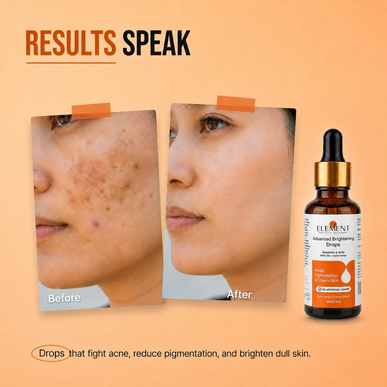 Before and after pigmentation results with The Element Advanced Brightening Drops