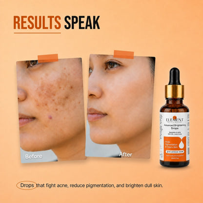 Before and after pigmentation results with The Element Advanced Brightening Drops