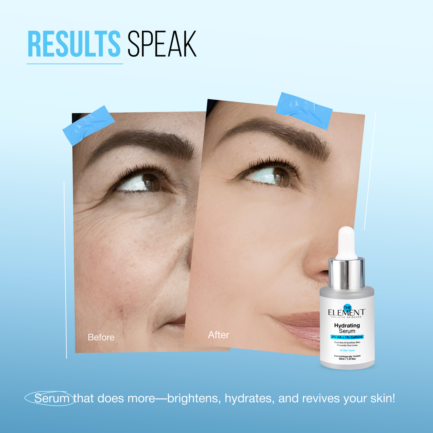 Results Speak — before and after on mature skin with the Hydrating Serum