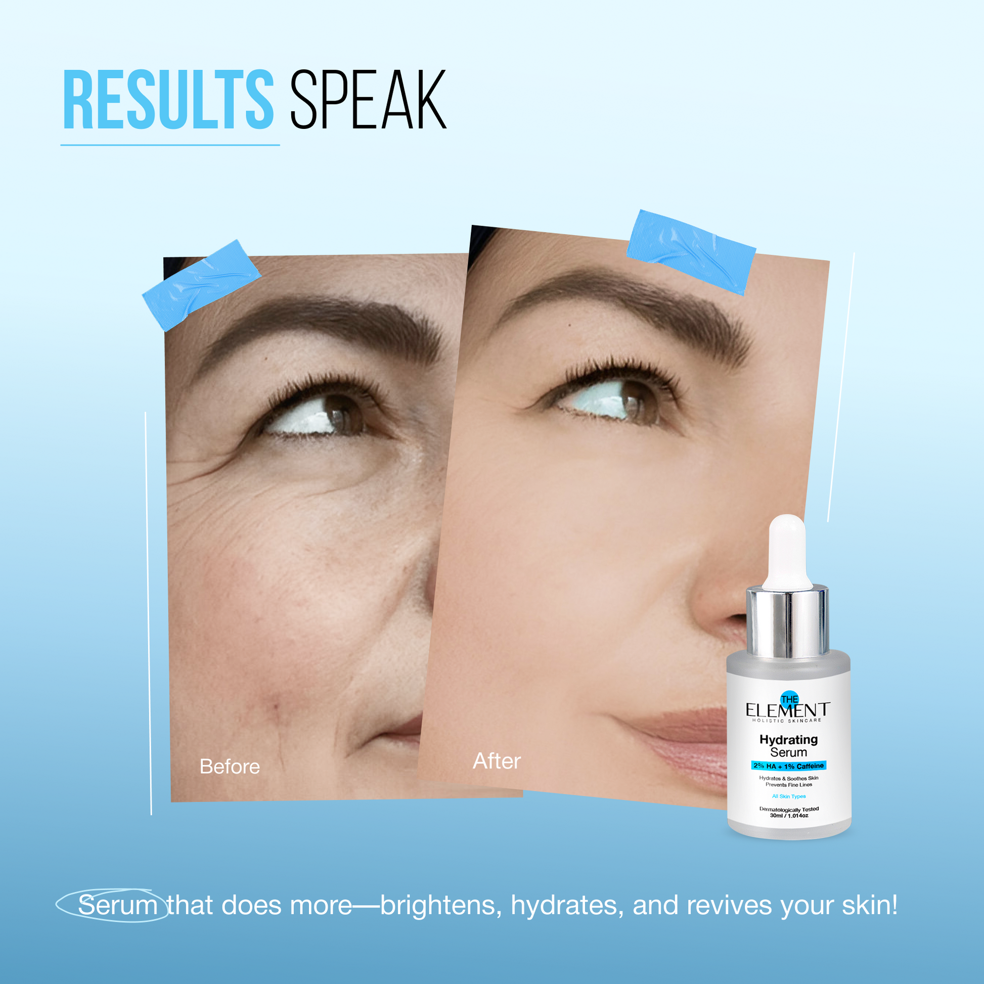 Results Speak — before and after on mature skin with the Hydrating Serum