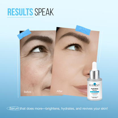 Results Speak — before and after on mature skin with the Hydrating Serum