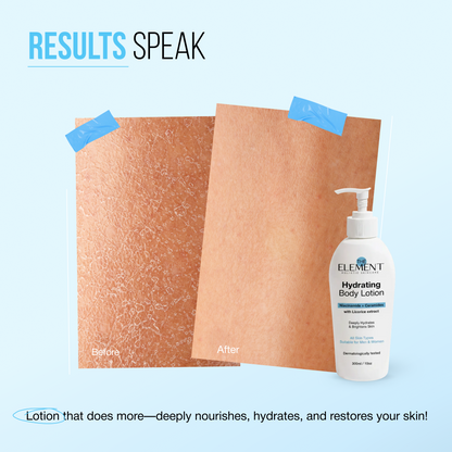 Hydrating Body Lotion - before and after