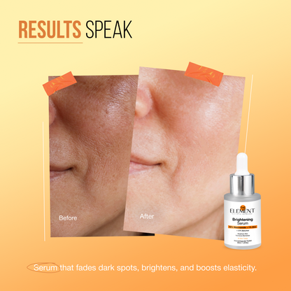 Ultimate Brightening Combo - 10% Niacinamide Serum + 2% Niacinamide SPF 50 PA++++ Sunscreen