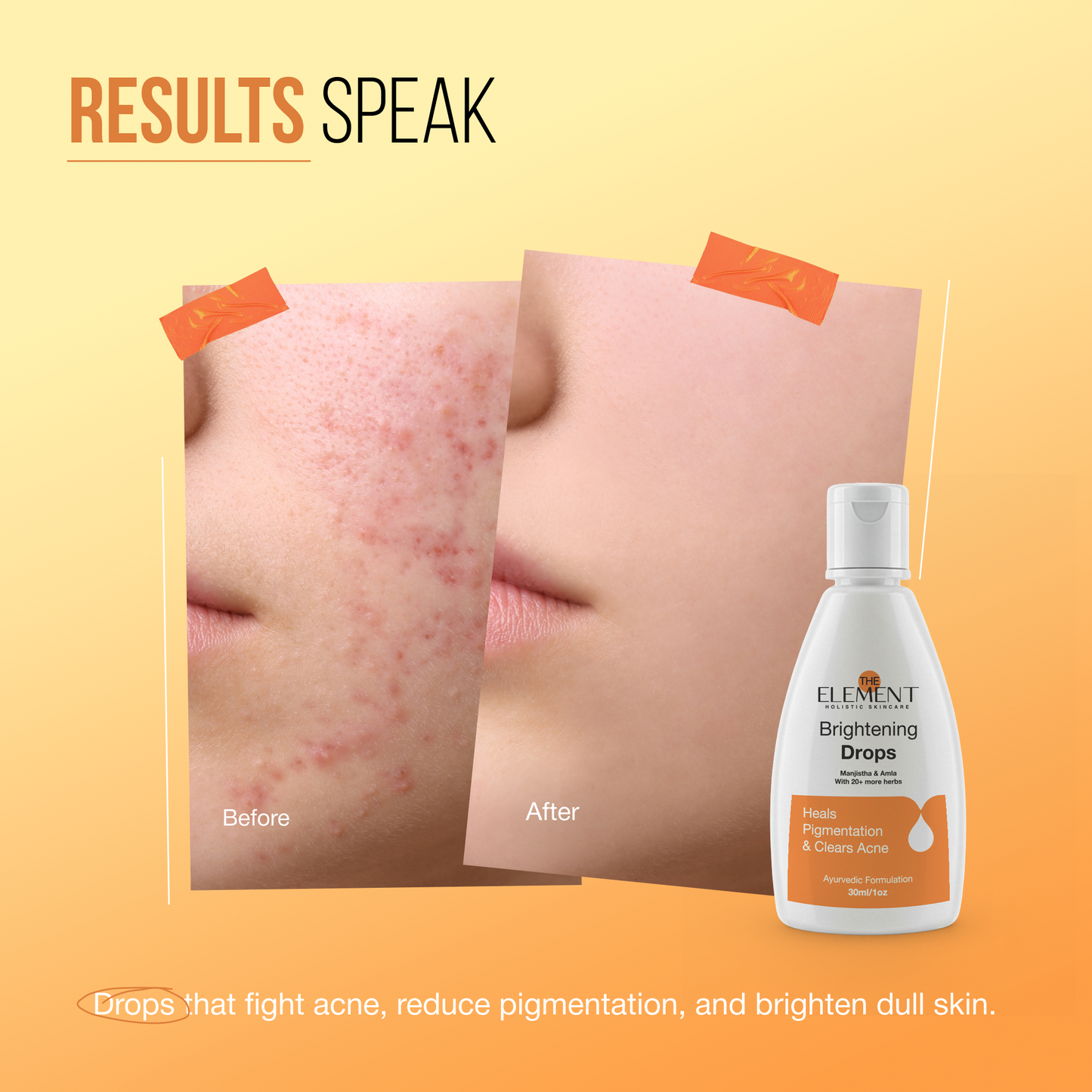 The Element Brightening Drops with Manjistha & Amla