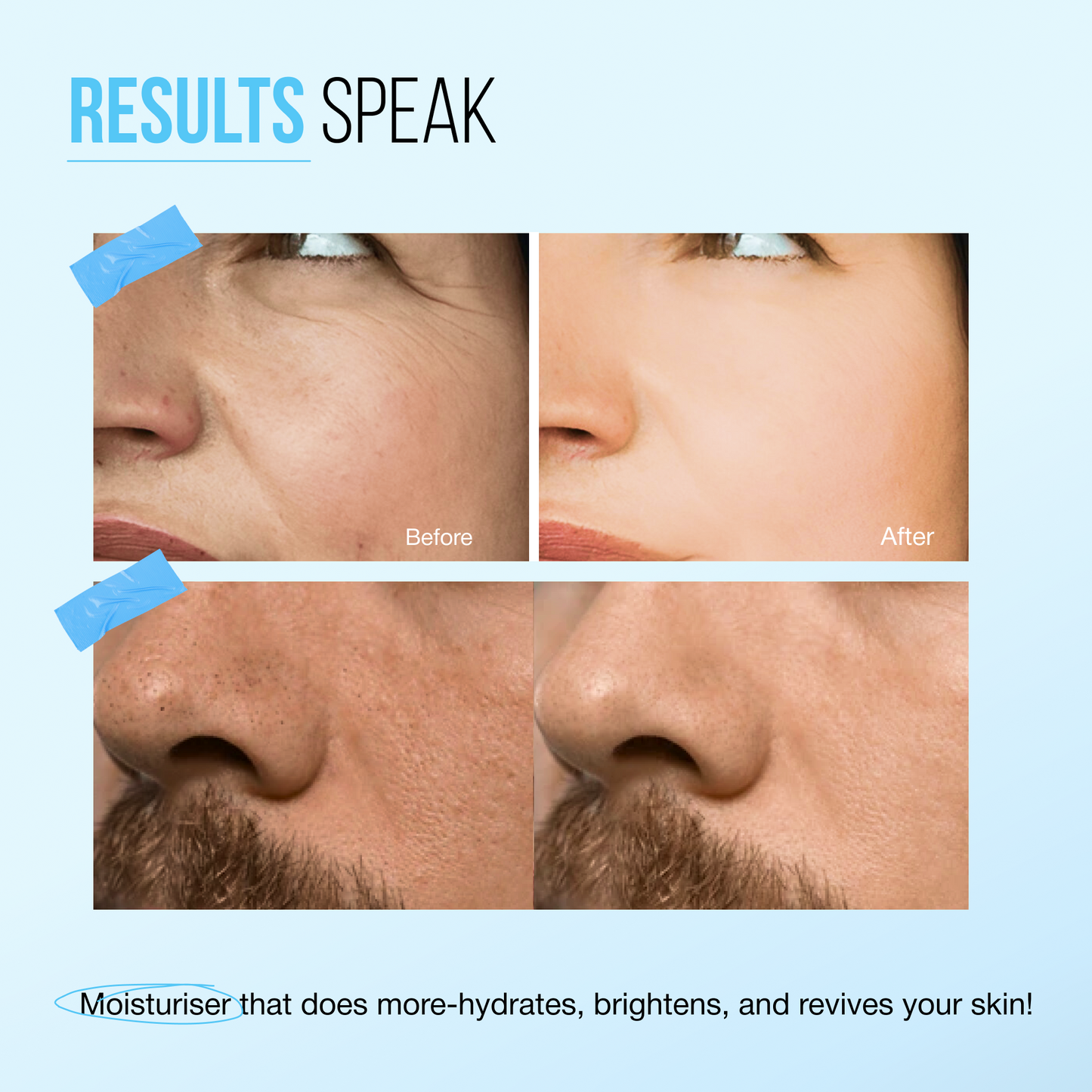 2% Hyaluronic Acid + Japanese Rice Water  Hydrating Face Moisturiser