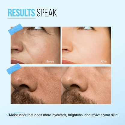 2% Hyaluronic Acid + Japanese Rice Water  Hydrating Face Moisturiser