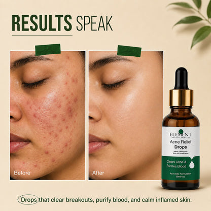 The Element Acne Relief Drops with Neem, Turmeric & Shatavari — Dropper