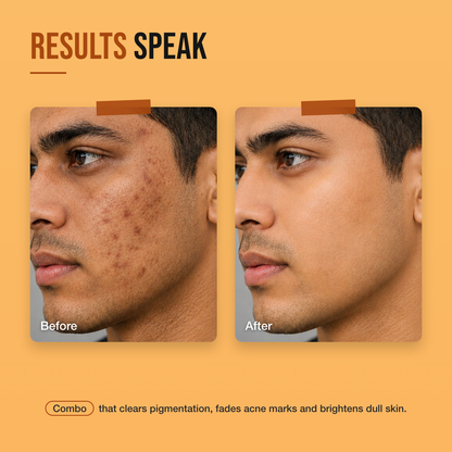 Complete Brightening Solution before and after on men — pigmentation and acne marks visibly lighter