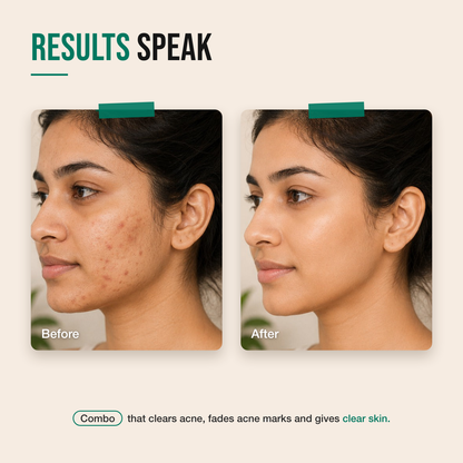 Ultimate Clear Skin Combo before and after — acne and post-acne marks visibly reduced